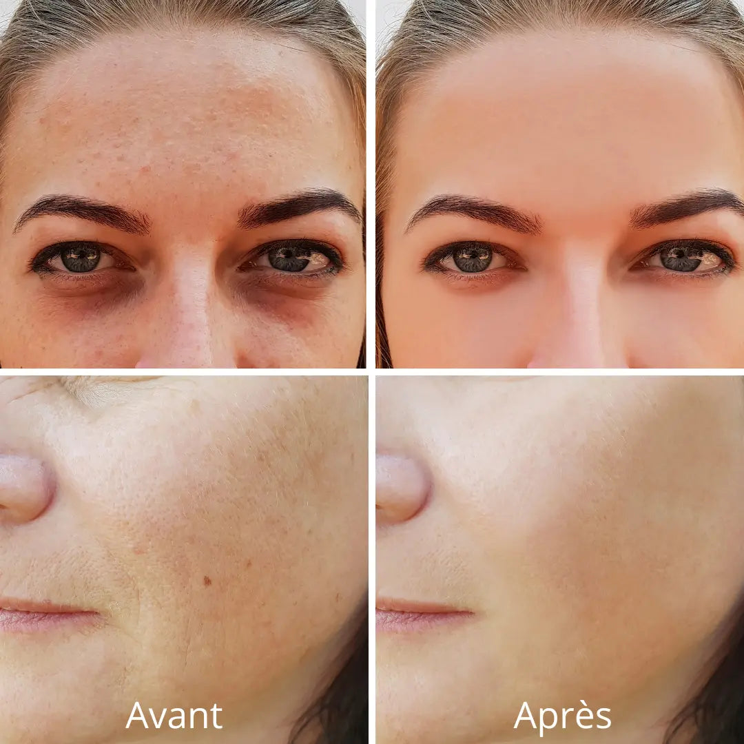 Masque Photothérapie LED Pro 7-Spectres – Anti-âge, Acné & Éclat en 10 Min/Jour