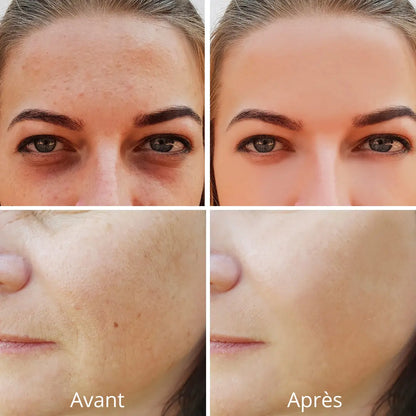 Masque Photothérapie LED Pro 7-Spectres – Anti-âge, Acné & Éclat en 10 Min/Jour